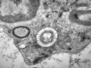 phagocytosed microbe phagocytosed microbe
